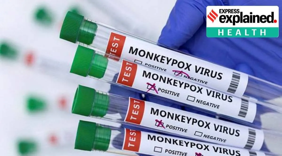 monkeypox infection explained, monkeypox treatment, Monkeypox spread, குரங்கு அம்மை நோய், குரங்கு அம்மைக்கான சிகிச்சை, வைரஸ் தடுப்பு மருந்துகள், monkeypox risk, Monkeypox news, Monkeypox origin, Monkeypox explained, Tamil Indian express news