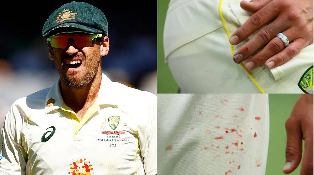 Cricket Tamil News; Starc bowls despite blood dripping off his finger on Day 3 at MCG